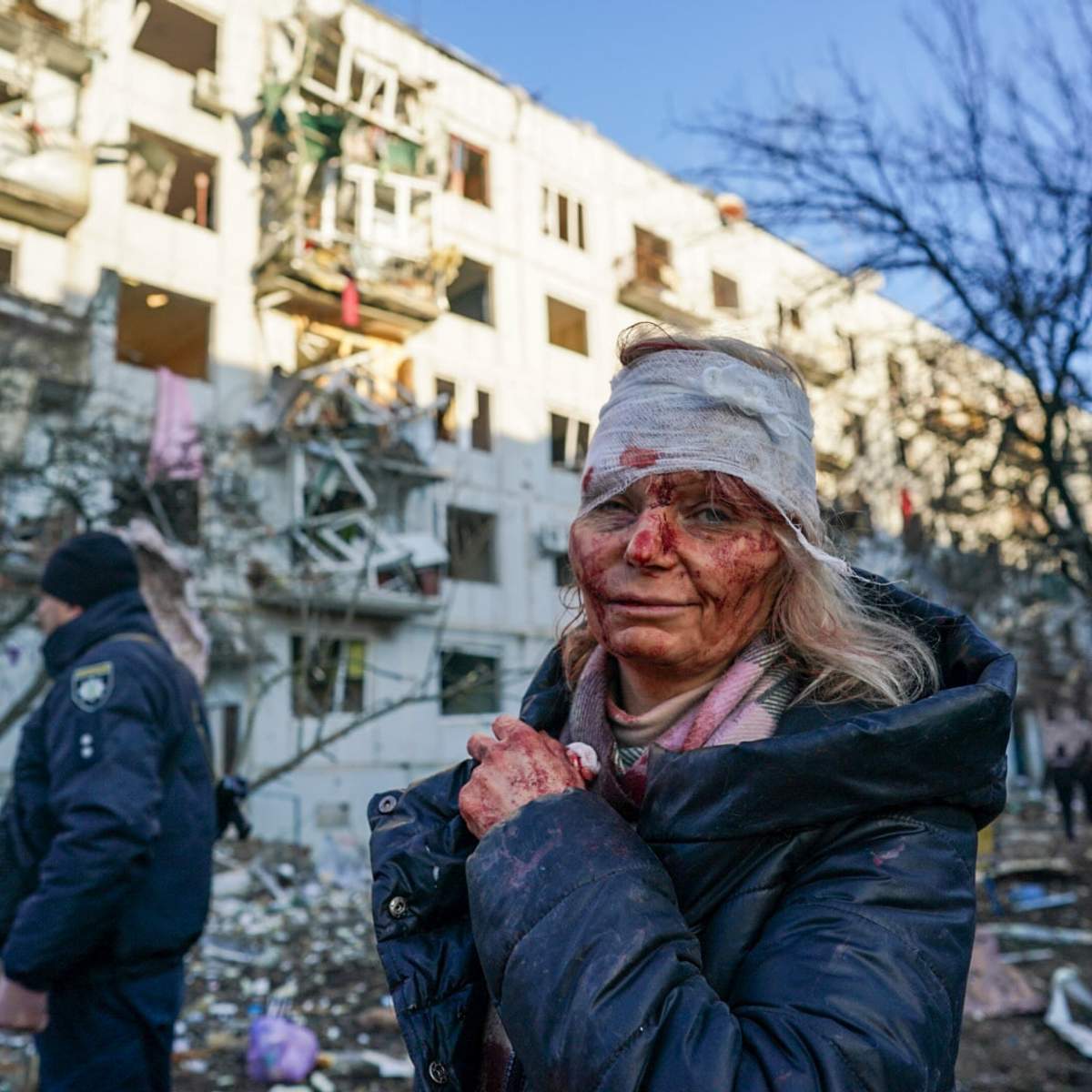 Жінка, яка постраждала внаслідок обстрілу Чугуєва Харківської області.
Фото — Anadolu Agency.